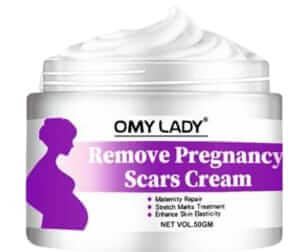 body stretch marks removal cream for women